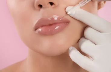 Filler