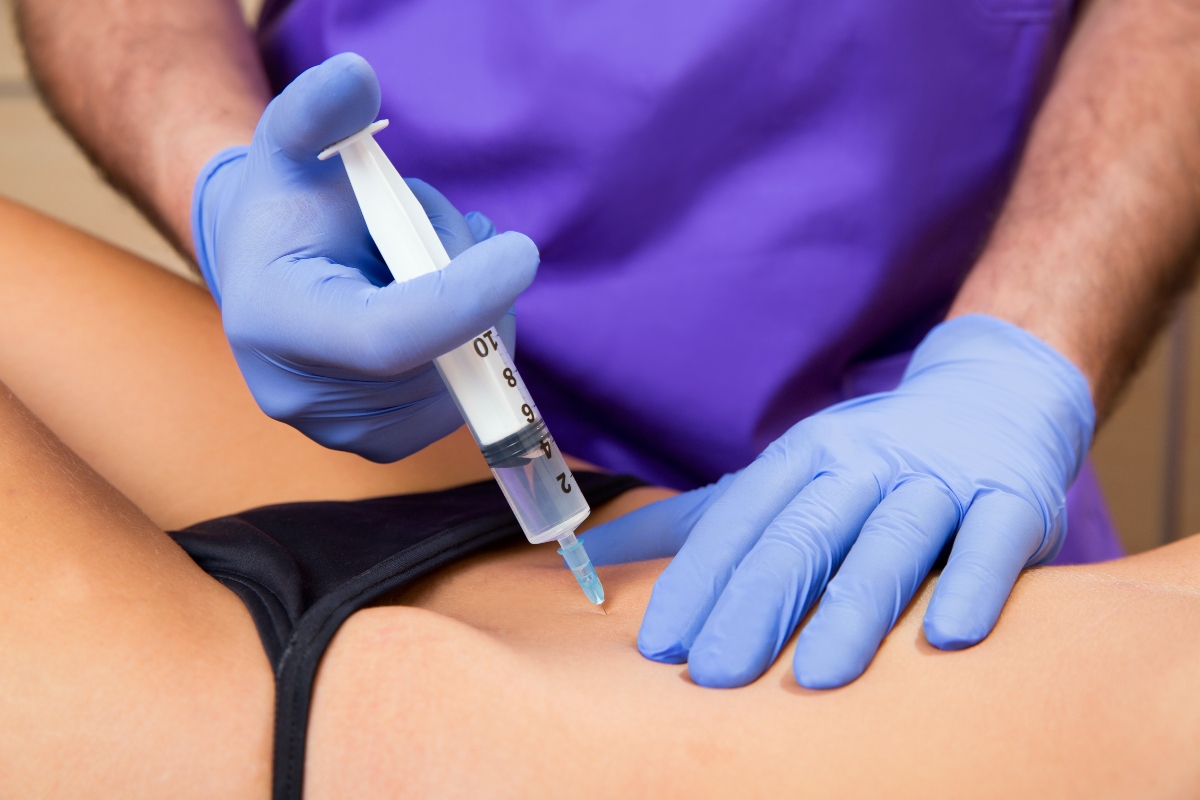 Mesoterapia